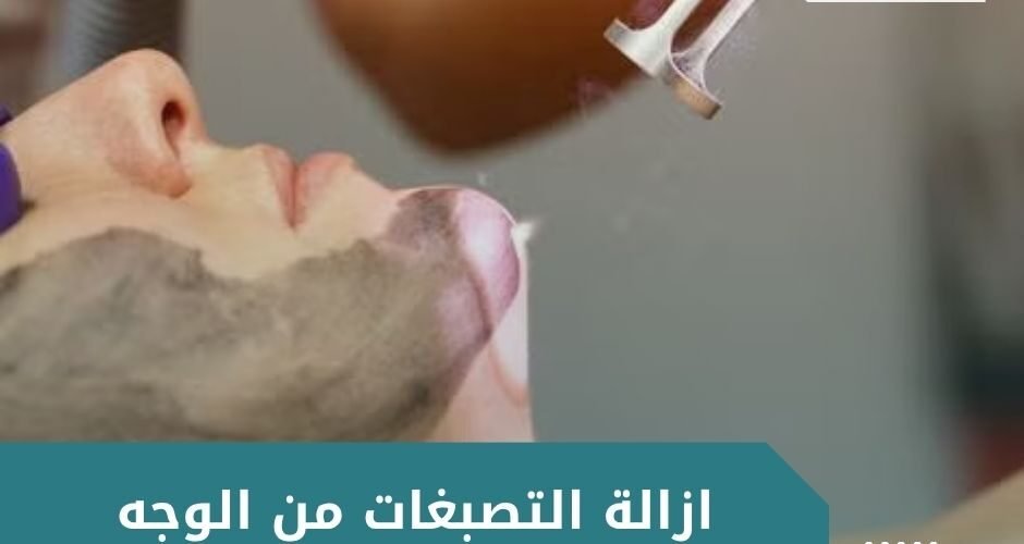 ازالة التصبغات من الوجه