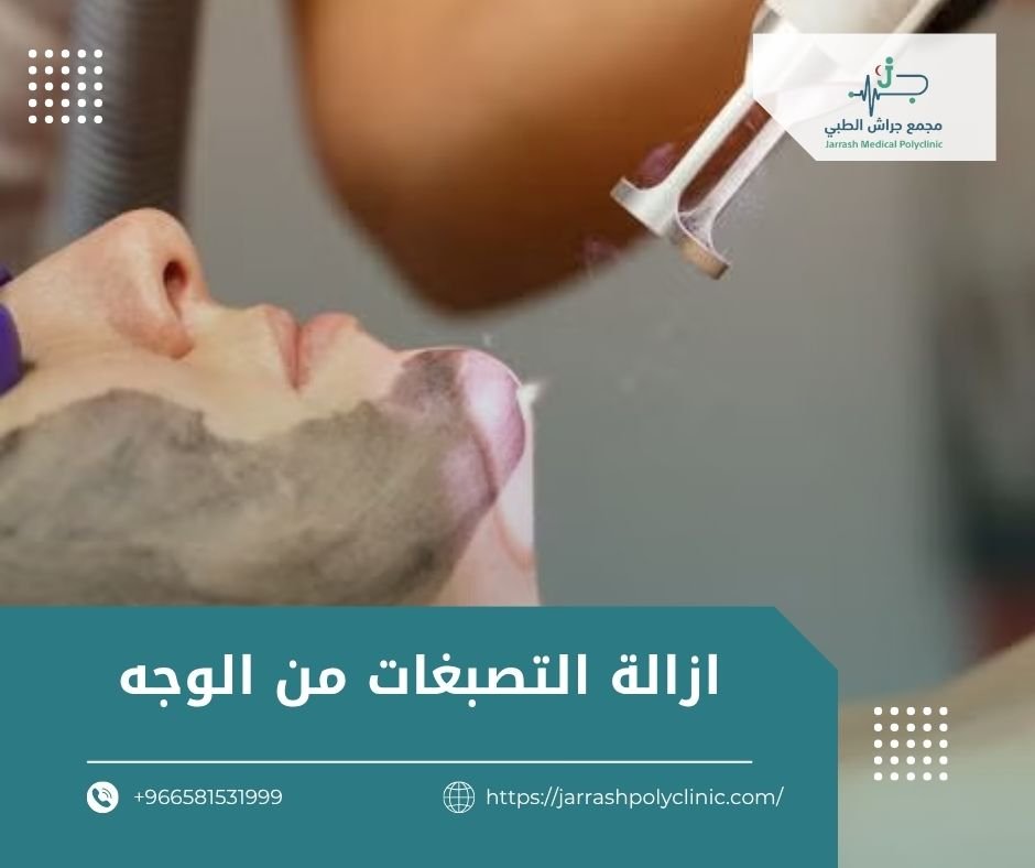 ازالة التصبغات من الوجه