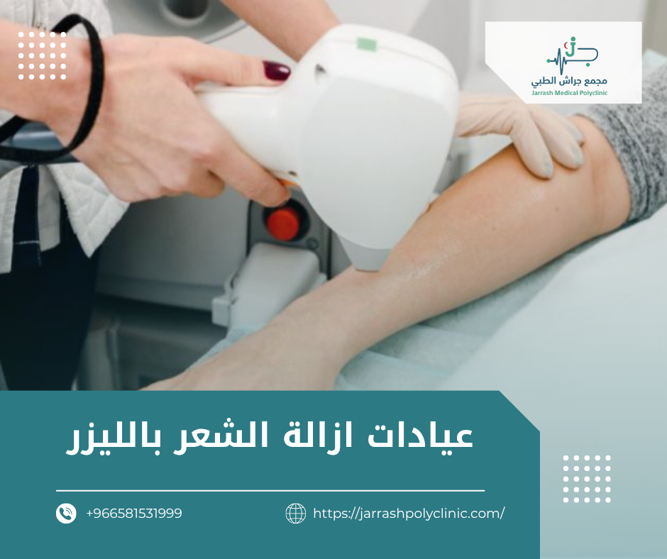 عيادات ازالة الشعر بالليزر​