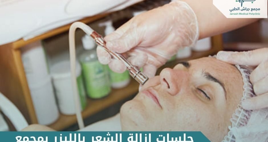 علاج ندبات حب الشباب