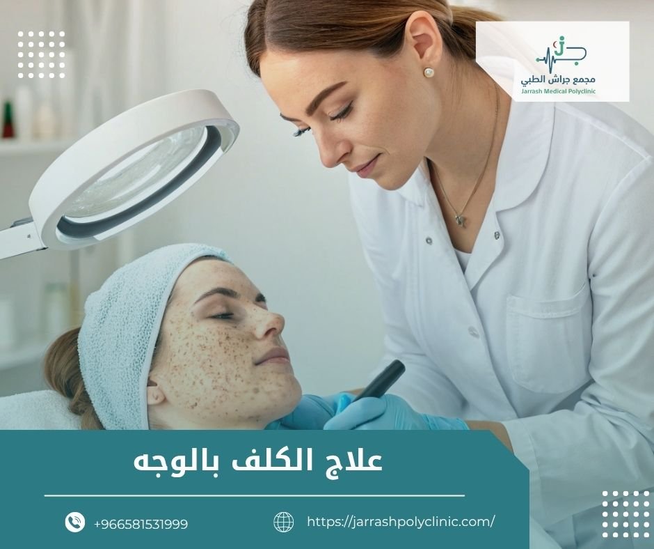 علاج الكلف بالوجه​