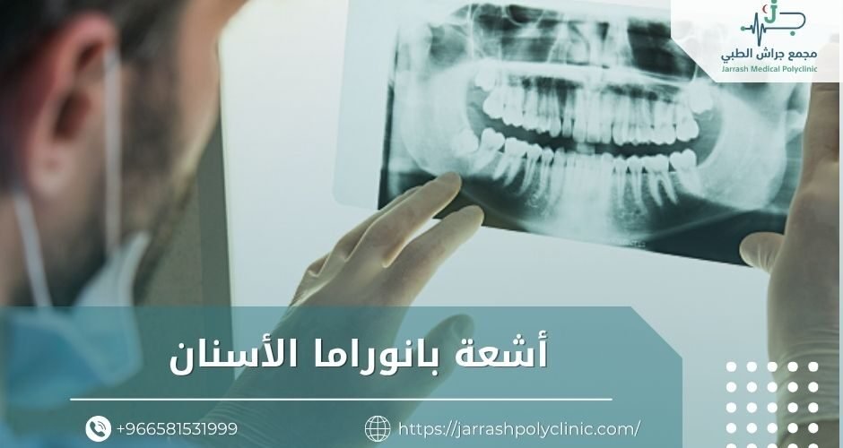 أشعة بانوراما الأسنان