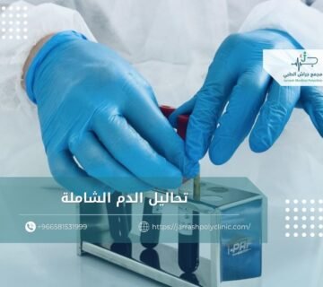 تحاليل الدم الشاملة