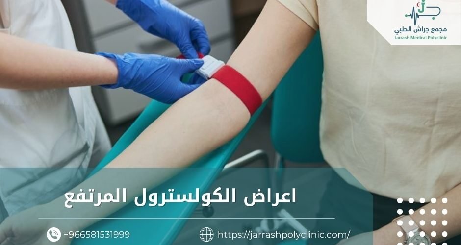 اعراض الكولسترول المرتفع