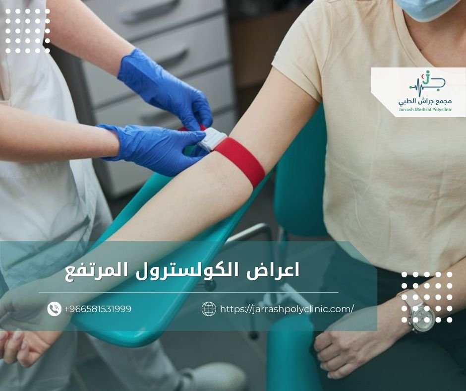 اعراض الكولسترول المرتفع