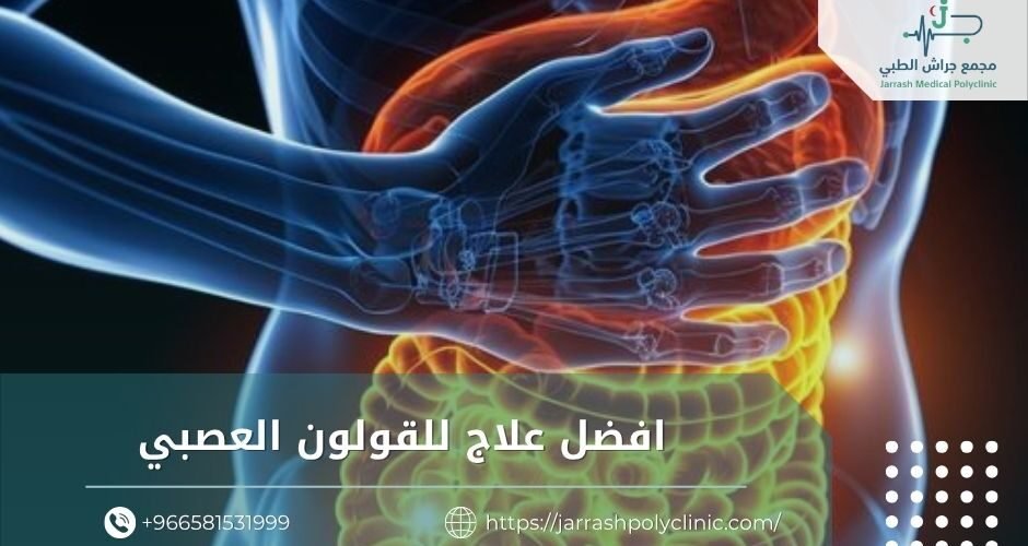 افضل علاج للقولون العصبي