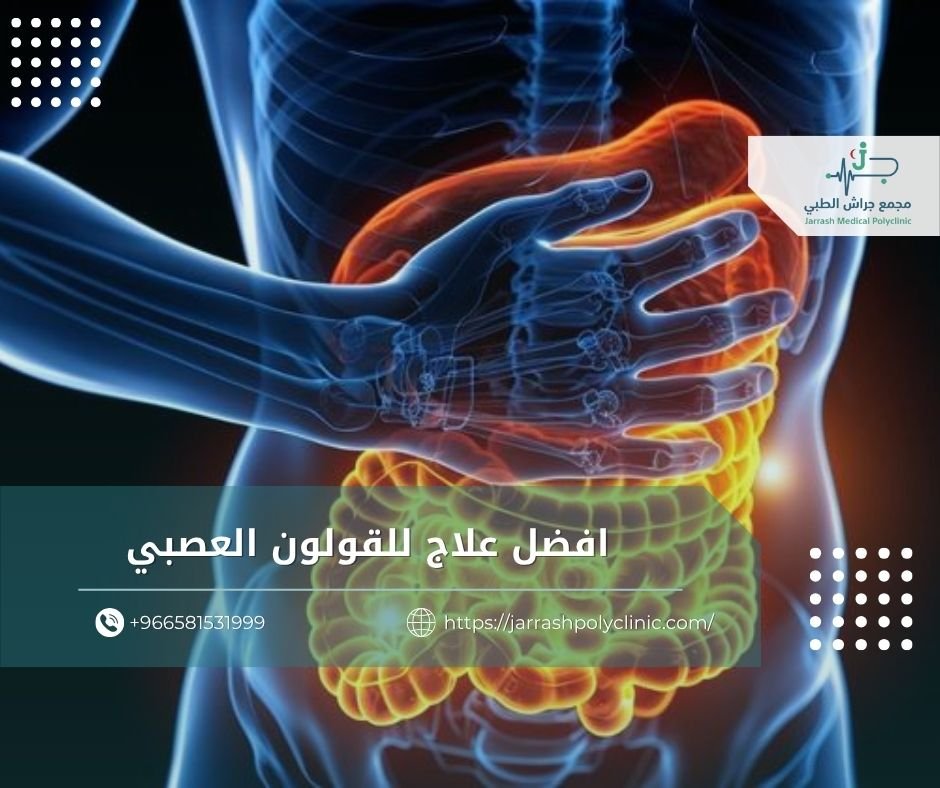 افضل علاج للقولون العصبي