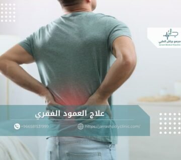 علاج العمود الفقري