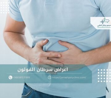 اعراض سرطان القولون