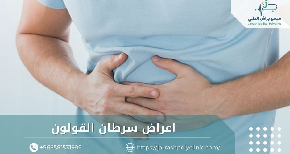 اعراض سرطان القولون