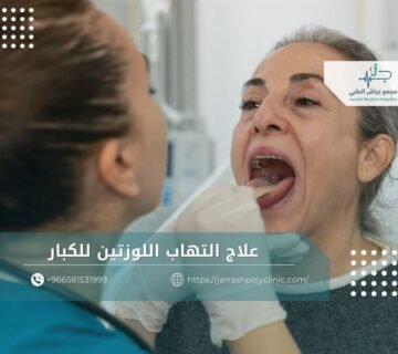 علاج التهاب اللوزتين للكبار