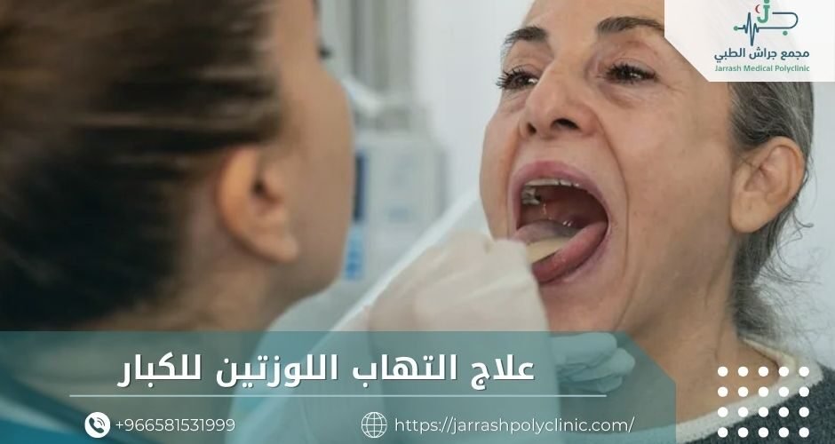 علاج التهاب اللوزتين للكبار