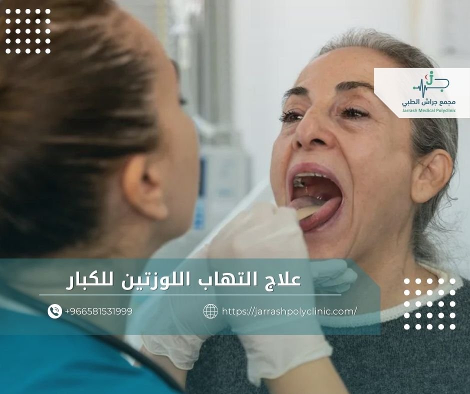 علاج التهاب اللوزتين للكبار