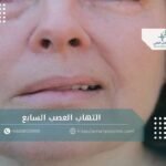 التهاب العصب السابع