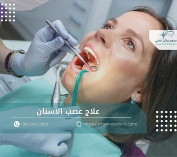 علاج عصب الاسنان​