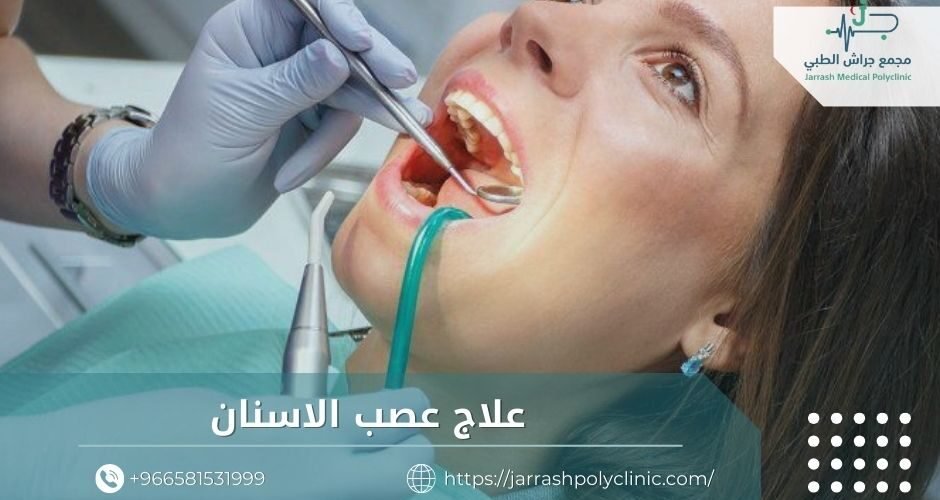 علاج عصب الاسنان​