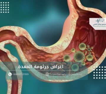اعراض جرثومة المعدة
