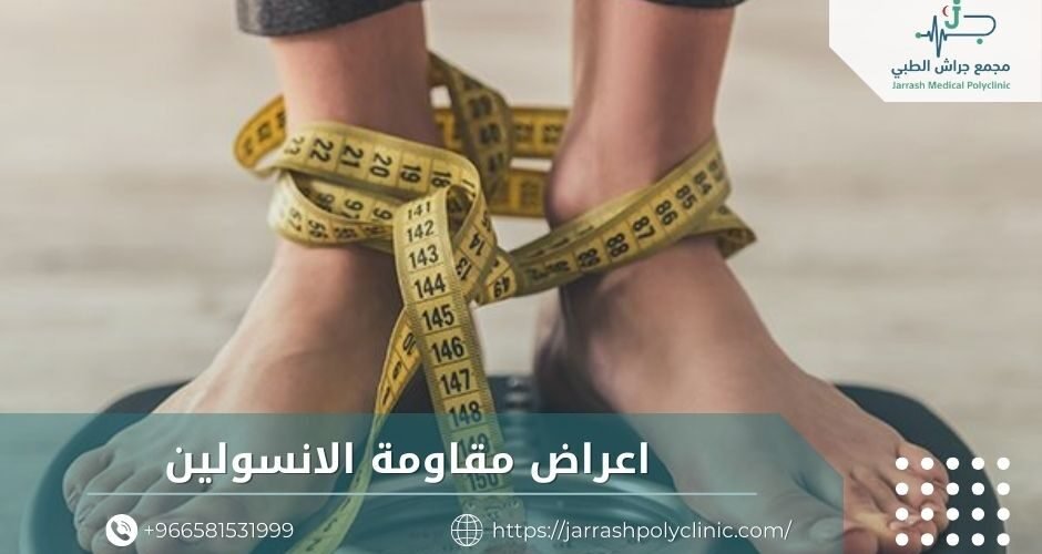 اعراض مقاومة الانسولين