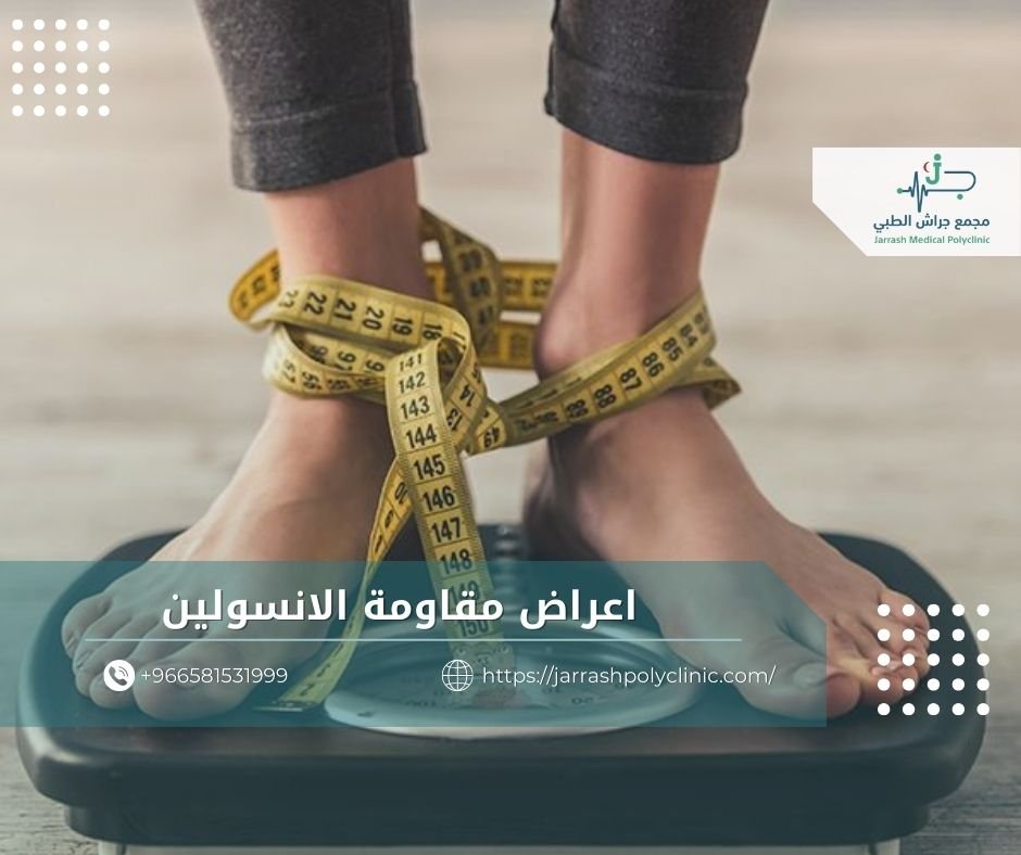 اعراض مقاومة الانسولين