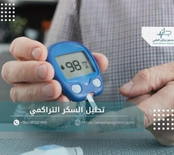 تحليل السكر التراكمي