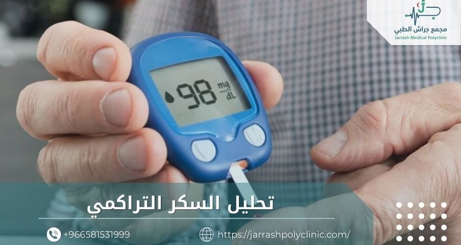 تحليل السكر التراكمي