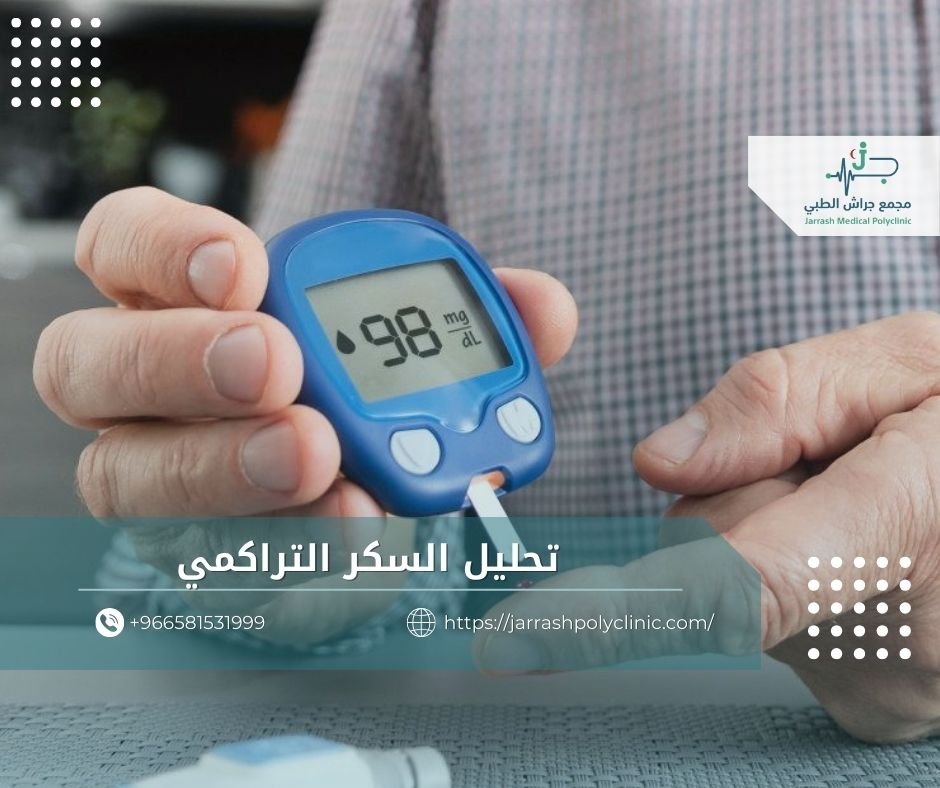 تحليل السكر التراكمي