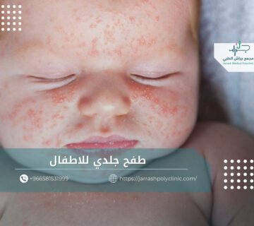 طفح جلدي للاطفال