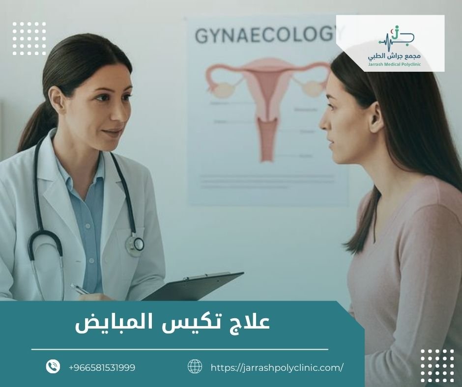 علاج تكيس المبايض