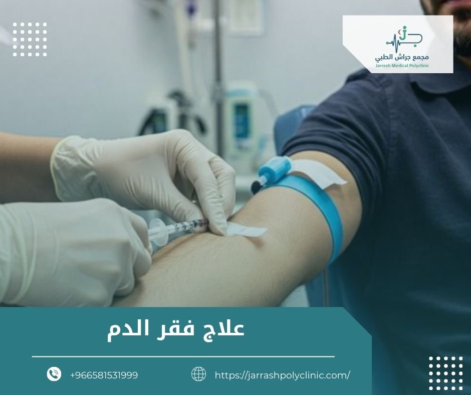 علاج فقر الدم