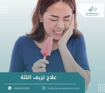 علاج نزيف اللثة