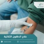 علاج الدهون الثلاثية