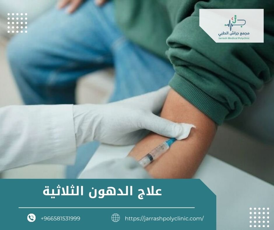 علاج الدهون الثلاثية