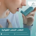 التهاب الشعب الهوائية