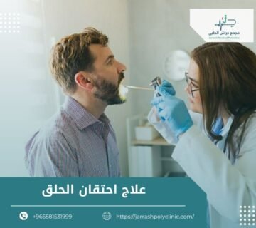 علاج احتقان الحلق