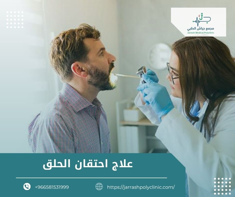 علاج احتقان الحلق