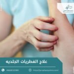 علاج الفطريات الجلديه
