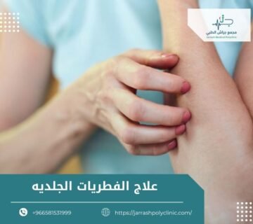 علاج الفطريات الجلديه