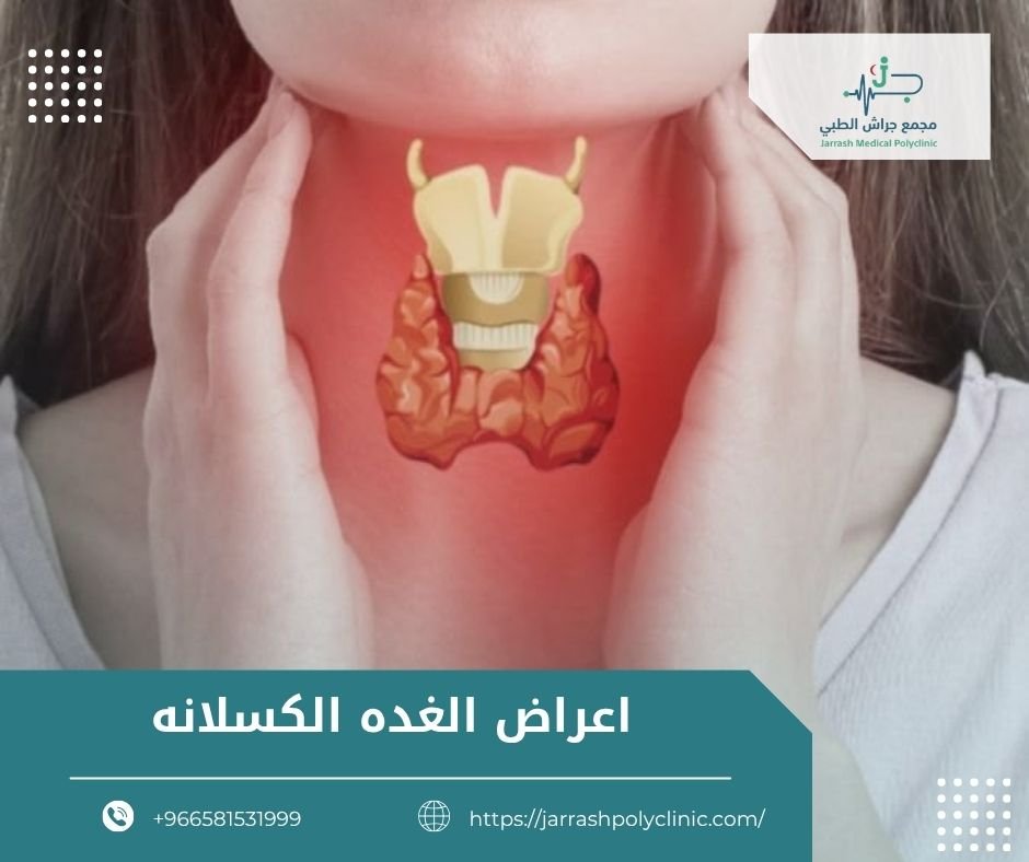 اعراض الغده الكسلانه