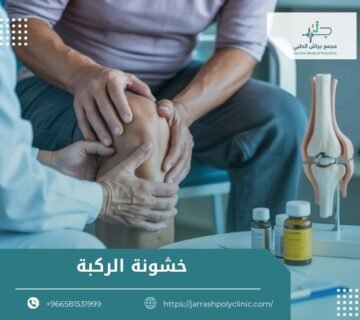 خشونة الركبة