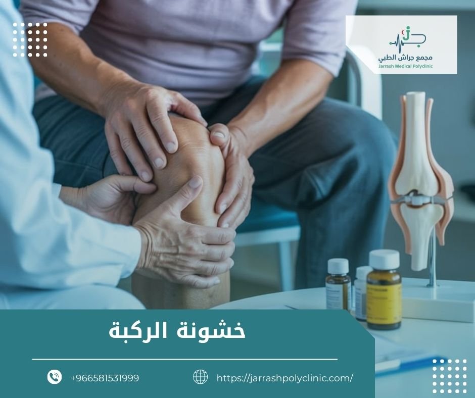 خشونة الركبة