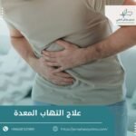 علاج التهاب المعدة