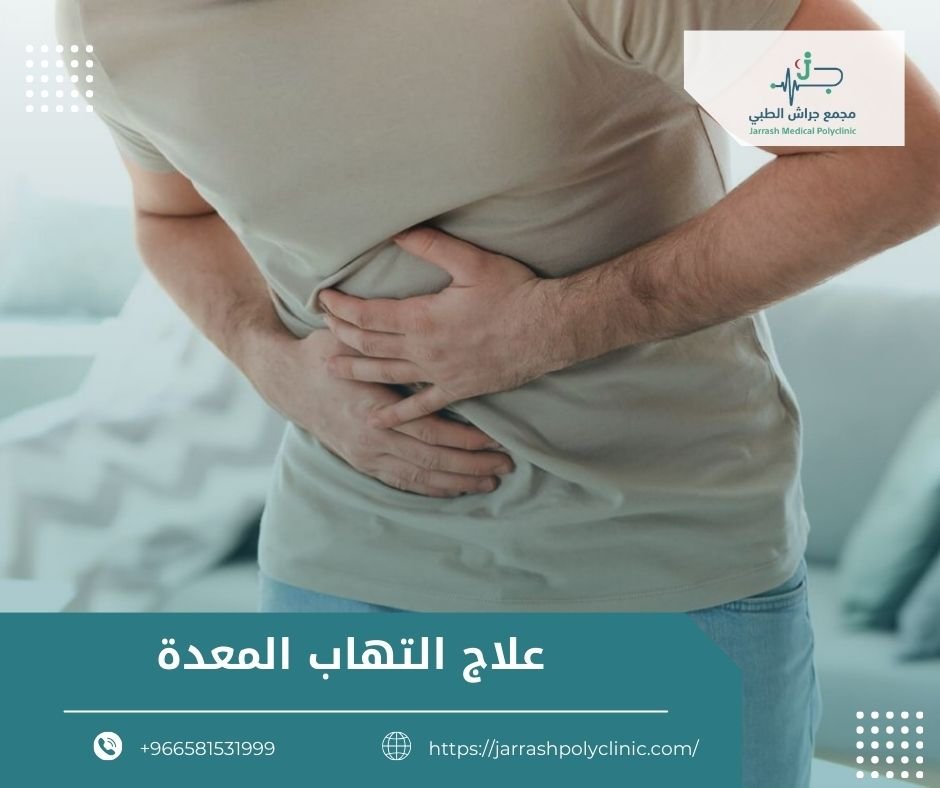 علاج التهاب المعدة