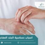 اسباب حساسية الجلد المفاجئة