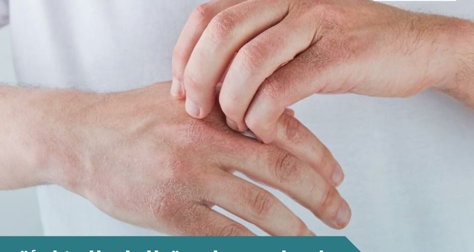 اسباب حساسية الجلد المفاجئة