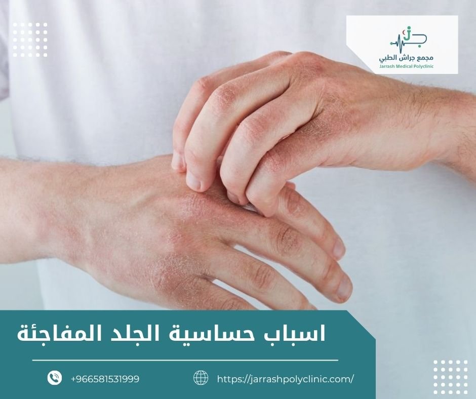 اسباب حساسية الجلد المفاجئة