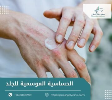 الحساسية الموسمية للجلد