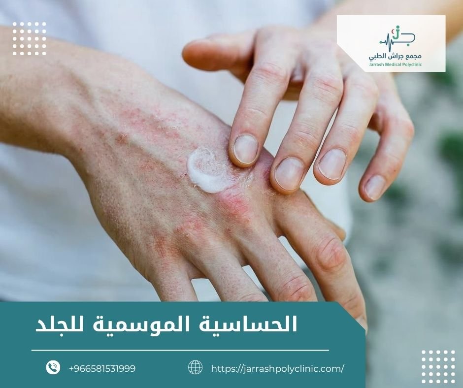 الحساسية الموسمية للجلد