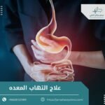 اعراض التهاب المعدة