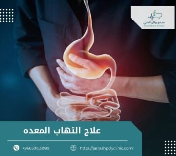 اعراض التهاب المعدة