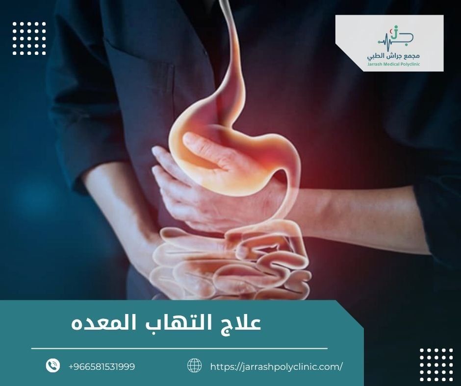 اعراض التهاب المعدة